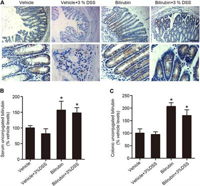 Unconjugated Bilirubin Attenuates DSS-Induced Colitis Potentially via Enhancement of Bilirubin Reabsorption